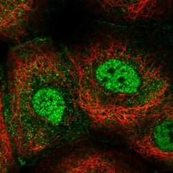 GPBP1L1 Antibody, Novus Biologicals 25 &mu;L; Unlabeled:Antibodies, Polyclonal